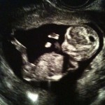 Being Pregnant makes Everything Har...